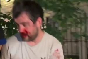 捷克vs墨西哥-7-被打到退出刺籍！“邓肯”惨遭纽约暴徒围殴！血流满面脱球衣保命